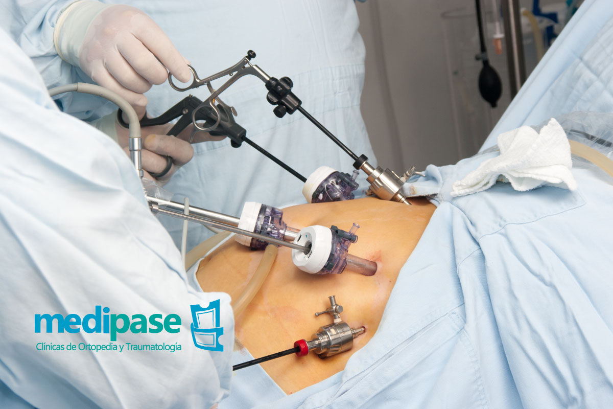 los cirujanos realizan pequeñas incisiones mínimas para realizar un procedimiento quirúrgico y utilizan la ayuda de pequeñas cámaras flexibles y luces para ver el interior del cuerpo